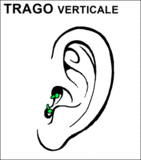 3-5 mesi