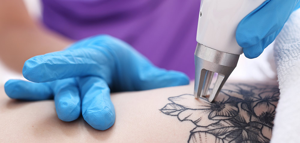 lasermedicalpic